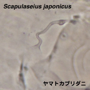 Scapulaseius japonicus